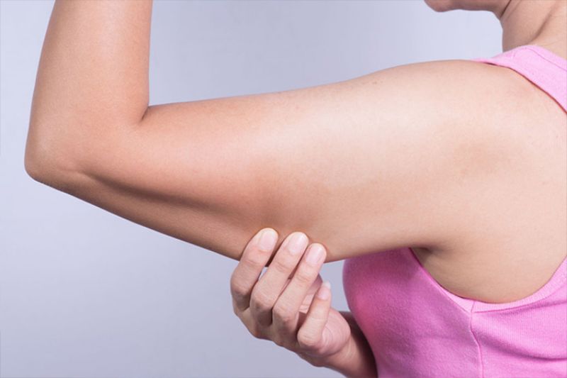 ¿Cómo tonificar los brazos flácidos?
