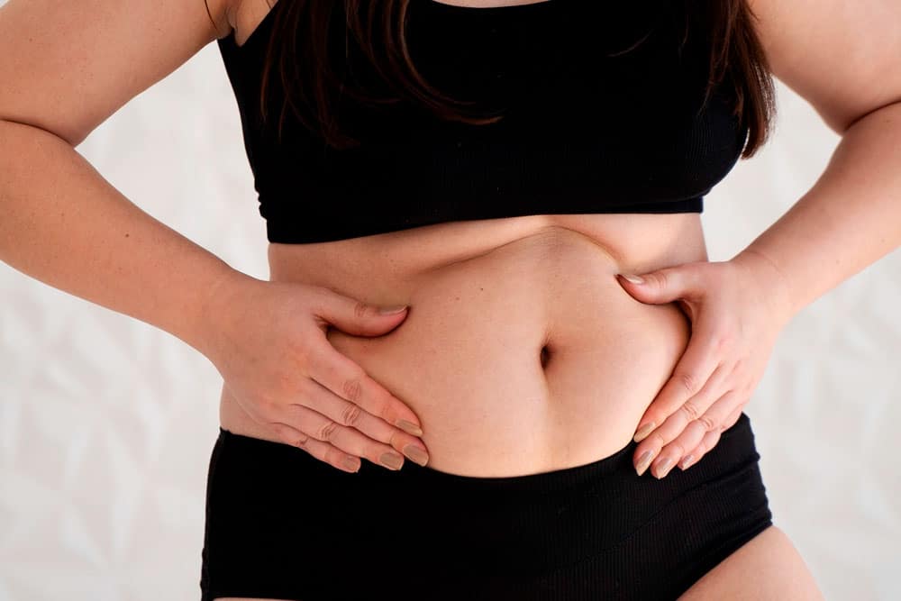 Tratamientos para reducir abdomen sin cirugía